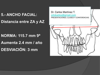5.- ANCHO FACIAL:Distancia entre ZA y AZNORMA: 115.7 mm 9ªAumenta 2.4 mm / añoDESVIACIÓN: 3 mmDr. Carlos Martínez T.ortokarlos@gmail.comPRESENTACIONES, CLASES Y CONFERENCIAS.