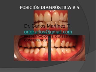 Posición diagnóstica # 4Dr. Carlos Martínez T.ortokarlos@gmail.comPRESENTACIONES, CLASES Y CONFERENCIAS.
