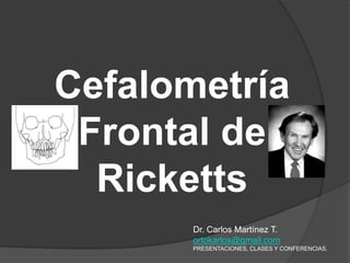 Cefalometría Frontal de Ricketts Dr. Carlos Martínez T. ortokarlos@gmail.com PRESENTACIONES, CLASES Y CONFERENCIAS. 