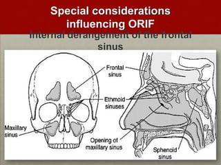 Special considerations
influencing ORIF
Internal derangement of the frontal
sinus

 
