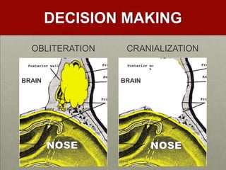 DECISION MAKING
OBLITERATION

BRAIN

CRANIALIZATION

BRAIN

 