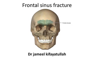 Frontal sinus fracture
Dr jameel kifayatullah
 