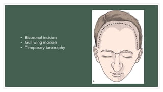 Gullwing Incision Rhinoplasty Frontal sinus surgeries | PPTX