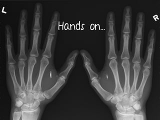 Hands on...
 
