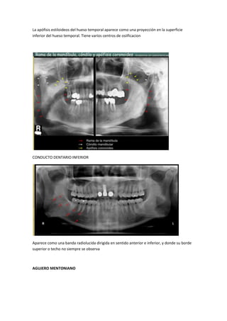 La apófisis estiloideos del hueso temporal aparece como una proyección en la superficie
inferior del hueso temporal. Tiene varios centros de osiificacion




CONDUCTO DENTARIO INFERIOR




Aparece como una banda radiolucida dirigida en sentido anterior e inferior, y donde su borde
superior o techo no siempre se observa



AGUJERO MENTONIANO
 
