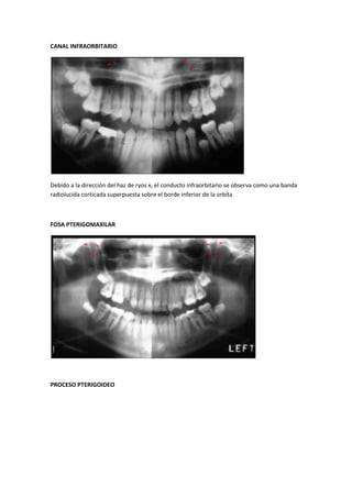 CANAL INFRAORBITARIO




Debido a la dirección del haz de ryos x, el conducto infraorbitario se observa como una banda
radiolucida corticada superpuesta sobre el borde inferior de la orbita



FOSA PTERIGOMAXILAR




PROCESO PTERIGOIDEO
 