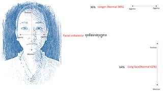 64%
36% Longer (Normal 38%)
Long face(Normal 62%)
Trichion
Mention
ZygomaZygoma
ZygomaZygoma
Trichion
Mention
Facial unbalance មុខមិនមានតុលយភាេ
 