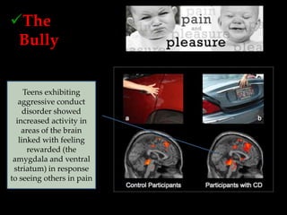 The
 Bully
o The Victim
o Bystanders

     Teens exhibiting
   aggressive conduct
     disorder showed
  increased activity in
    areas of the brain
   linked with feeling
      rewarded (the
 amygdala and ventral
 striatum) in response
to seeing others in pain
 
