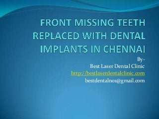 By-
Best Laser Dental Clinic
http://bestlaserdentalclinic.com
bestdentalno1@gmail.com
 