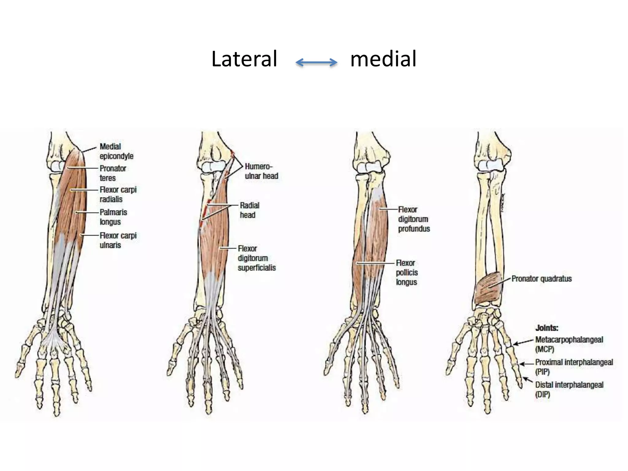 Lateral medial