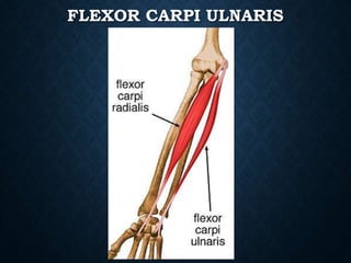 FLEXOR CARPI ULNARIS
 