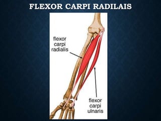 FLEXOR CARPI RADILAIS
 