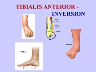 Front of leg | PPTX