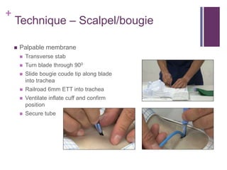 +
Technique – Scalpel/bougie
 Palpable membrane
 Transverse stab
 Turn blade through 900
 Slide bougie coude tip along blade
into trachea
 Railroad 6mm ETT into trachea
 Ventilate inflate cuff and confirm
position
 Secure tube
 