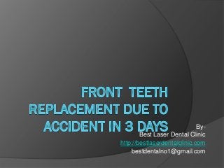 By-
Best Laser Dental Clinic
http://bestlaserdentalclinic.com
bestdentalno1@gmail.com
 