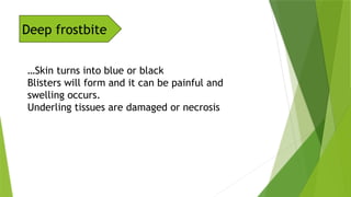 Forstbite Form Comprehensive Overview of Frostbite: Causes, Symptoms, and Treatment | PPTX