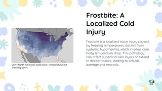 Frostbite A Cold in winter is very cold and so cold | PDF