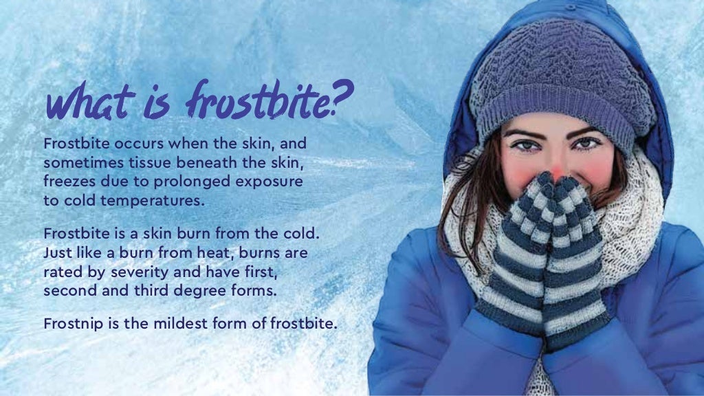 Cold Hard Facts About Frostbite