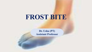 FROST BITE
Dr. Usha (PT)
Assistant Professor
 