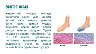 Хөлдөлт (Frostible) | PPT