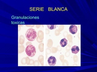 SERIE  BLANCA Granulaciones toxicas 