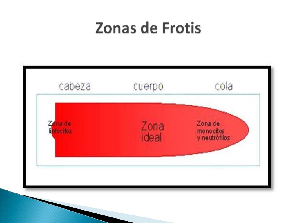 Frotis O Extensi n De Sangre