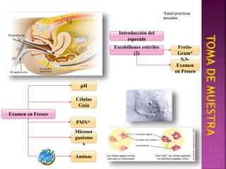 Frotis y cultivo de secrecion vaginal PPT