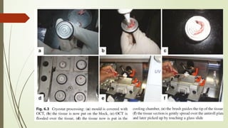 Techniques and Procedure Of FROZEN SECTION.pptx