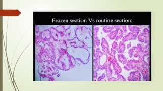 Techniques and Procedure Of FROZEN SECTION.pptx