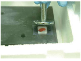 Frozen section and cryostat