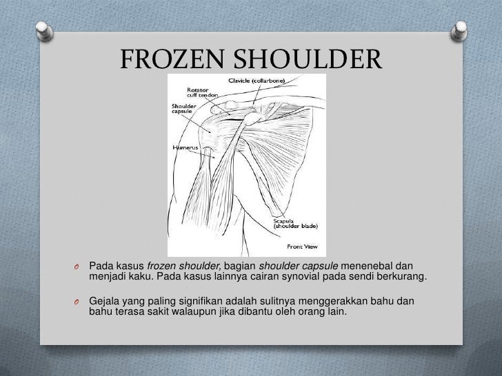 Frozen shoulder Frozen shoulder