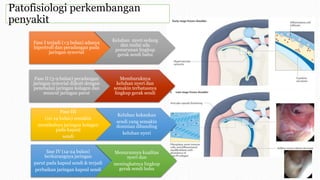 Fase I terjadi (<3 bulan) adanya
hipertrofi dan peradangan pada
jaringan synovial
Keluhan nyeri sedang
dan mulai ada
penurunan lingkup
gerak sendi bahu
Fase II (3-9 bulan) peradangan
jaringan synovial diikuti dengan
penebalan jaringan kolagen dan
muncul jaringan parut
Memburuknya
keluhan nyeri dan
semakin terbatasnya
lingkup gerak sendi
Fase III
(10-14 bulan) semakin
menebalnya jaringan kolagen
pada kapsul
sendi
Keluhan kekaukan
sendi yang semakin
dominan dibanding
keluhan nyeri
fase IV (14-24 bulan)
berkurangnya jaringan
parut pada kapsul sendi & terjadi
perbaikan jaringan kapsul sendi
Menurunnya kualitas
nyeri dan
meningkatnya lingkup
gerak sendi bahu
Patofisiologi perkembangan
penyakit
 