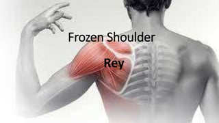 Frozen Shoulder
Rey
 