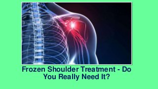 Frozen Shoulder Treatment - Do
You Really Need It?
 