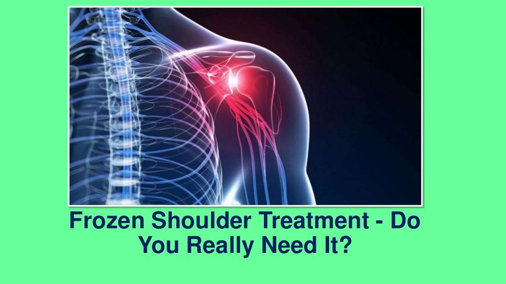 Frozen shoulder treatment do you really need it