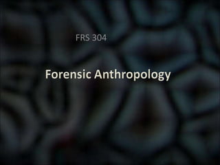 FRS 304
 
