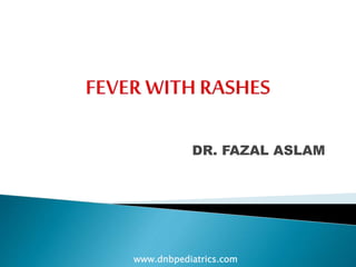 DR. FAZAL ASLAM
www.dnbpediatrics.com
 