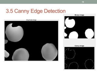 3.5 Canny Edge Detection
15
 