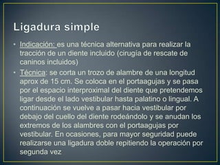• Indicación: es una técnica alternativa para realizar la
  tracción de un diente incluido (cirugía de rescate de
  caninos incluidos)
• Técnica: se corta un trozo de alambre de una longitud
  aprox de 15 cm. Se coloca en el portaagujas y se pasa
  por el espacio interproximal del diente que pretendemos
  ligar desde el lado vestibular hasta palatino o lingual. A
  continuación se vuelve a pasar hacia vestibular por
  debajo del cuello del diente rodeándolo y se anudan los
  extremos de los alambres con el portaagujas por
  vestibular. En ocasiones, para mayor seguridad puede
  realizarse una ligadura doble repitiendo la operación por
  segunda vez
 