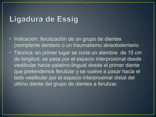 • Indicación: ferulización de un grupo de dientes
  (reimplante dentario o un traumatismo alveolodentario
• Técnica: en primer lugar se corta un alambre de 15 cm
  de longitud, se pasa por el espacio interproximal desde
  vestibular hacia palatino-lingual desde el primer diente
  que pretendemos ferulizar y se vuelve a pasar hacia el
  lado vestibular por el espacio interproximal distal del
  ultimo diente del grupo de dientes a ferulizar.
 