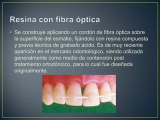 • Se construye aplicando un cordón de fibra óptica sobre
  la superficie del esmalte, fijándolo con resina compuesta
  y previa técnica de grabado ácido. Es de muy reciente
  aparición en el mercado odontológico, siendo utilizada
  generalmente como medio de contención post
  tratamiento ortodóncico, para lo cual fue diseñada
  originalmente.
 