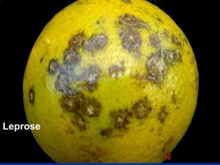 Leprose
 