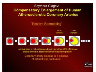 Seymour Glagov:
Compensatory Enlargement of Human
Atherosclerotic Coronary Arteries
”Positive Remodeling”
<50%
stenosis
<80%
stenosis
Luminal area is not endangered until more than 40% of internal
elastic lamina is destructed and occupied by plaque.
Coronary artery disease is a disease
of arterial wall not lumen.
 