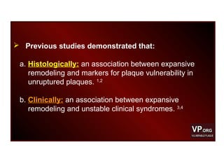  Previous studies demonstrated that:
a. Histologically: an association between expansive
remodeling and markers for plaque vulnerability in
unruptured plaques. 1,2
b. Clinically: an association between expansive
remodeling and unstable clinical syndromes. 3,4
 