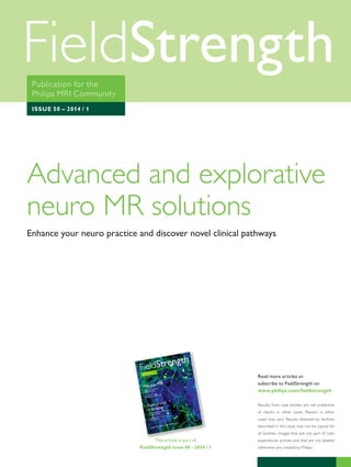 Publication for the 
Philips MRI Community 
ISSUE 50 – 2014 / 1 
Advanced and explorative 
neuro MR solutions 
Enhance your neuro practice and discover novel clinical pathways 
This article is part of 
FieldStrength issue 50 - 2014 / 1 
Read more articles or 
subscribe to FieldStrength on 
www.philips.com/fieldstrength 
Results from case studies are not predictive 
of results in other cases. Results in other 
cases may vary. Results obtained by facilities 
described in this issue may not be typical for 
all facilities. Images that are not part of User 
experiences articles and that are not labeled 
otherwise are created by Philips. 
 