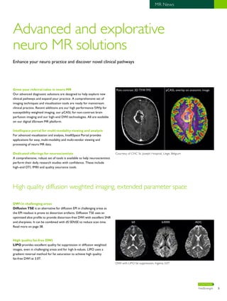 5 MR News 
Post contrast 3D T1W FFE pCASL overlay on anatomic image 
b0 b3000 ADC 
CONTINUE 
Advanced and explorative 
neuro MR solutions 
Enhance your neuro practice and discover novel clinical pathways 
Grow your referral value in neuro MR 
Our advanced diagnostic solutions are designed to help explore new 
clinical pathways and expand your practice. A comprehensive set of 
imaging techniques and visualization tools are ready for mainstream 
clinical practice. Recent additions are our high performance SWIp for 
susceptibility weighted imaging, our pCASL for non-contrast brain 
perfusion imaging and our high-end DWI technologies. All are available 
on our digital dStream MR platform. 
Intellispace portal for multi-modality viewing and analysis 
For advanced visualization and analysis, IntelliSpace Portal provides 
applications for easy, multi-modality and multi-vendor viewing and 
processing of neuro MR data. 
Dedicated offerings for neuroscientists 
A comprehensive, robust set of tools is available to help neuroscientists 
perform their daily research studies with confidence. These include 
high-end DTI, fMRI and quality assurance tools. 
Courtesy of CHC St. Joseph Hospital, Liege, Belgium 
High quality diffusion weighted imaging, extended parameter space 
DWI in challenging areas 
Diffusion TSE is an alternative for diffusion EPI in challenging areas as 
the EPI readout is prone to distortion artifacts. Diffusion TSE uses an 
optimized slice profile to provide distortion-free DWI with excellent SNR 
and sharpness. It can be combined with dS SENSE to reduce scan time. 
Read more on page 38. 
High quality fat-free DWI 
LIPO provides excellent quality fat suppression in diffusion weighted 
images, even in challenging areas and for high b-values. LIPO uses a 
gradient reversal method for fat saturation to achieve high quality 
fat-free DWI at 3.0T. 
DWI with LIPO fat suppression, Ingenia 3.0T 
FieldStrength 5 
 