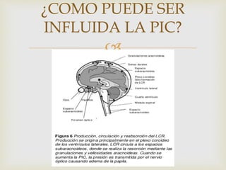 
¿COMO PUEDE SER
INFLUIDA LA PIC?
 