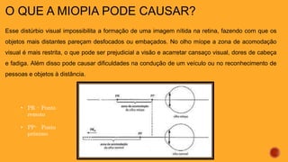 O QUE A MIOPIA PODE CAUSAR?
Esse distúrbio visual impossibilita a formação de uma imagem nítida na retina, fazendo com que os
objetos mais distantes pareçam desfocados ou embaçados. No olho míope a zona de acomodação
visual é mais restrita, o que pode ser prejudicial a visão e acarretar cansaço visual, dores de cabeça
e fadiga. Além disso pode causar dificuldades na condução de um veículo ou no reconhecimento de
pessoas e objetos à distância.
• PR - Ponto
remoto
• PP- Ponto
próximo
 