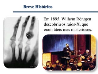 Breve Histórico
Em 1895, Wilhem Röntgen
descobriu os raios-X, que
eram úteis mas misteriosos.
 