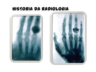 HISTORIA DA RADIOLOGIA
 
